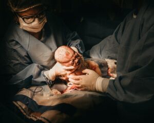 woman giving birth to baby via c section