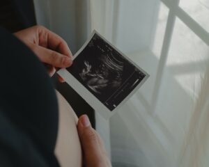 person holding an ultrasound scan photo