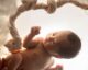 peaceful newborn portrait in dreamy setting